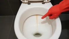 Everyone Knows This Yellow Stripe—Not Everyone Knows the Simple Trick to Get Rid of It